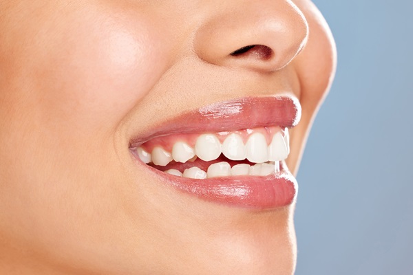 Pros And Cons Of Teeth Whitening